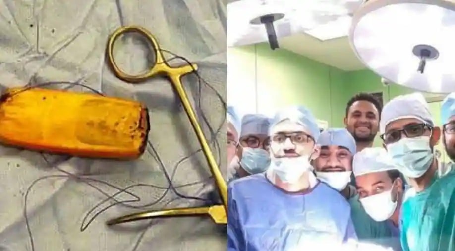 Фотография: Египетские врачи достали из кишечника пациента мобильник, который находился там полгода №1 - BigPicture.ru