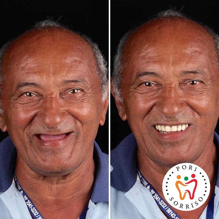 Фотография: 30 фото до и после того, как людям вернули улыбку №5 - BigPicture.ru