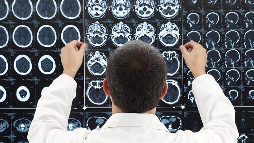 Фотография: Медики из США впервые излечили депрессию, вживив в мозг человека имплант №4 - BigPicture.ru