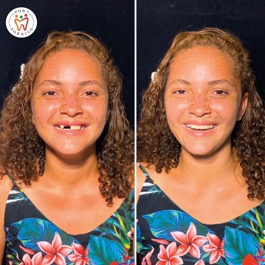 Фотография: 30 фото до и после того, как людям вернули улыбку №9 - BigPicture.ru