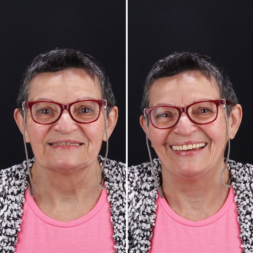 Фотография: 30 фото до и после того, как людям вернули улыбку №16 - BigPicture.ru