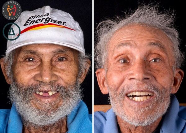 30 фото до и после того, как людям вернули улыбку