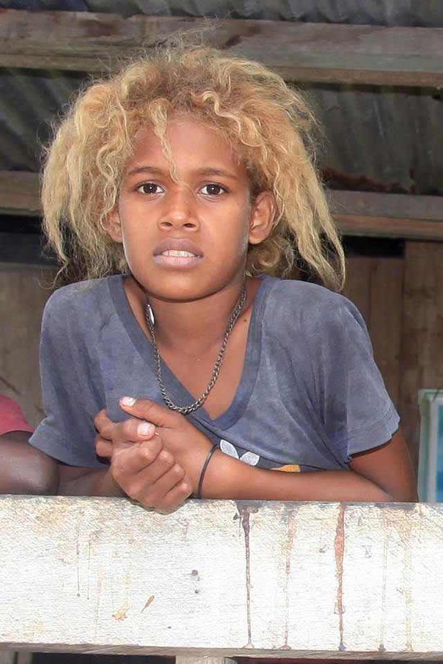 Фотография: Почему на Соломоновых островах рождаются темнокожие блондины №6 - BigPicture.ru