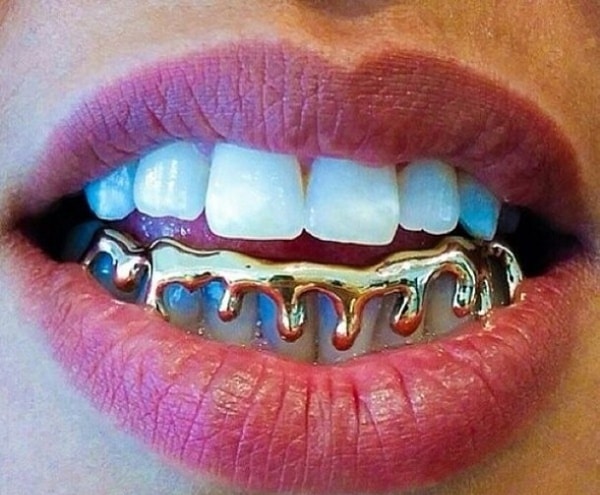 Фотография: Это модно? Зуб даю! Как эпатажная мода прокралась в стоматологию №7 - BigPicture.ru