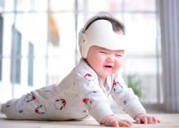 Странная китайская новинка — шлем для исправления формы головы у новорожденных