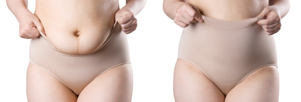 Фотография: Трусы для красы: 7 ошибок, которые женщины делают при выборе нижнего белья №2 - BigPicture.ru