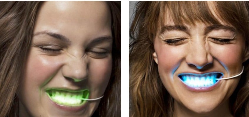 Фотография: Это модно? Зуб даю! Как эпатажная мода прокралась в стоматологию №6 - BigPicture.ru