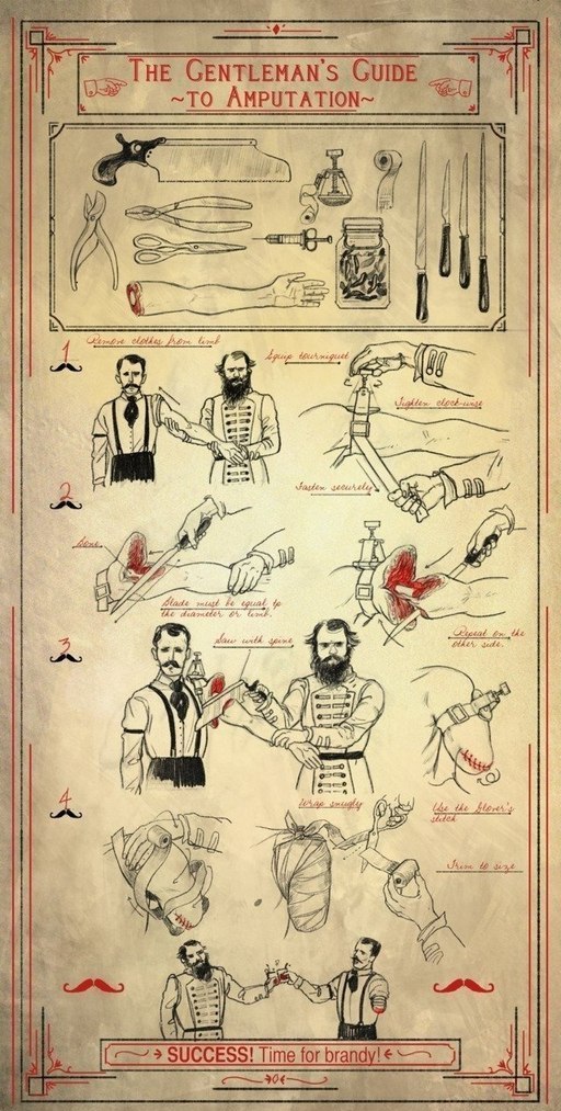 Bigpicture.ru Шуточная инструкция по ампутации руки 19 века