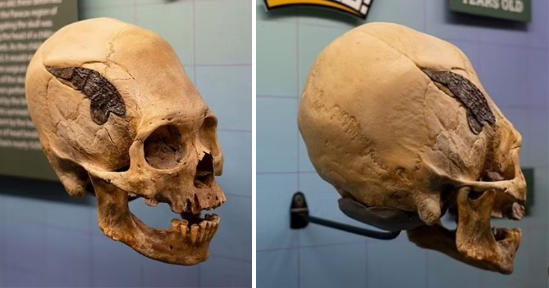 Bigpicture.ru 2-тысячелетний череп перуанского воина