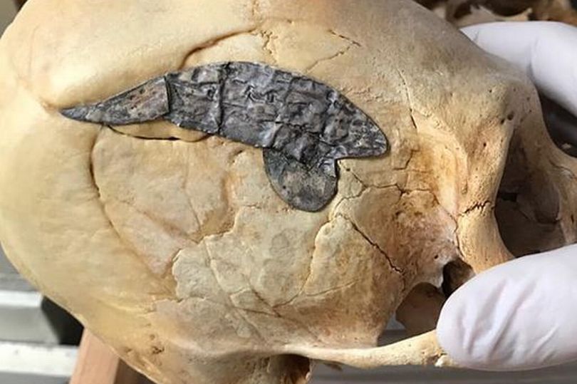 Bigpicture.ru 2-тысячелетний череп перуанского воинаskull metal