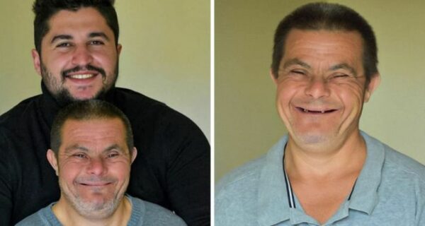 Мужчина с синдромом Дауна стал отцом и теперь гордится сыном-врачом