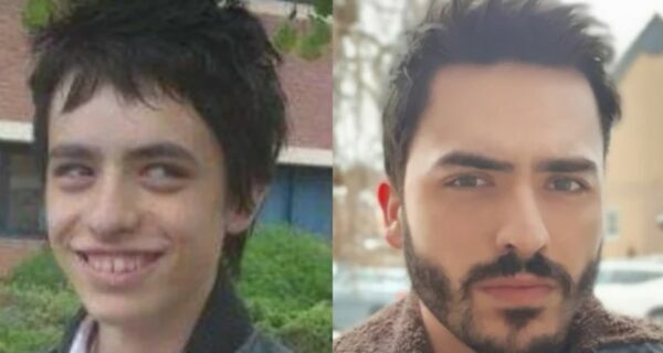 22 фото людей, которые превратились из «гадких утят» в «прекрасных лебедей»