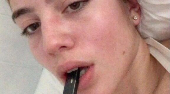 Молодая американка чуть не стала инвалидом из-за курения вейпа