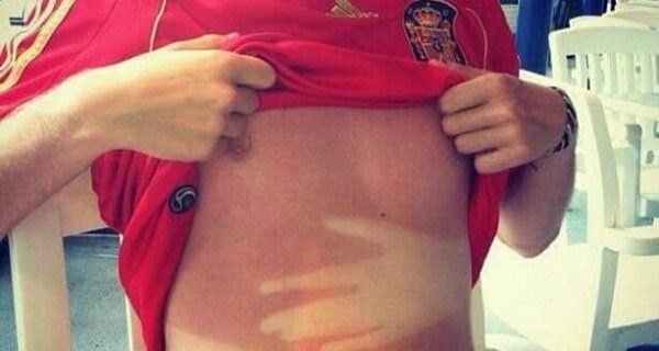 Загорать нужно с умом, и вот 22 доказательства