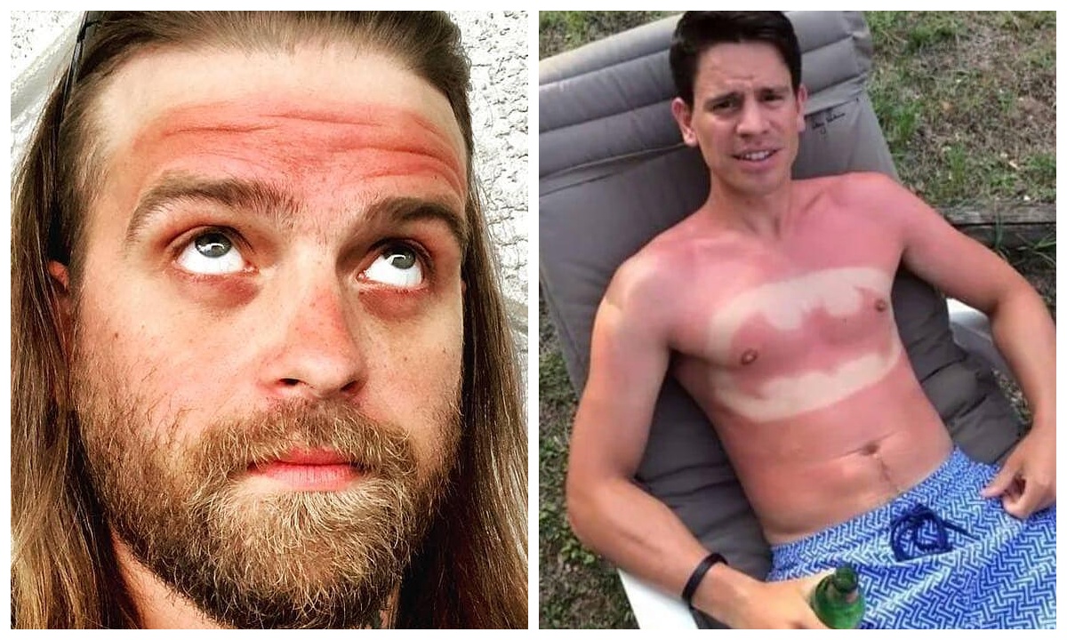 Загорать нужно с умом, и вот 22 доказательства » BigPicture.ru