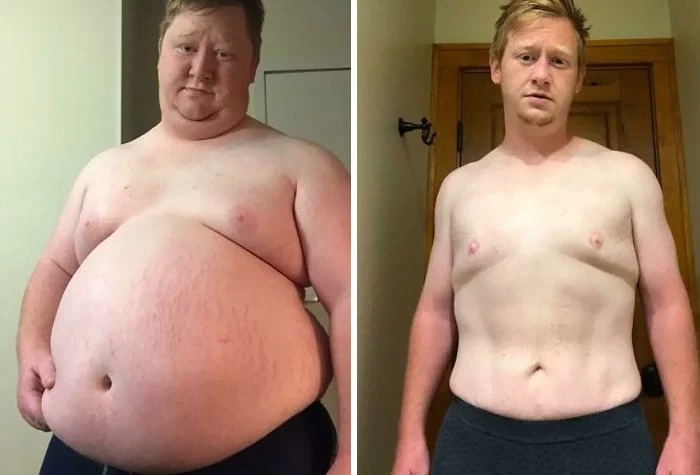 Вдохновляющие примеры кардинального преображения: 30 фото до и после похудения