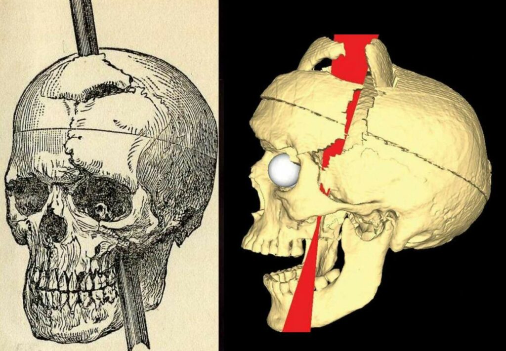 Bigpicture.ru Удивительная история Финеаса Гейджа - человека с ломом в черепе20210730 164425 compress14