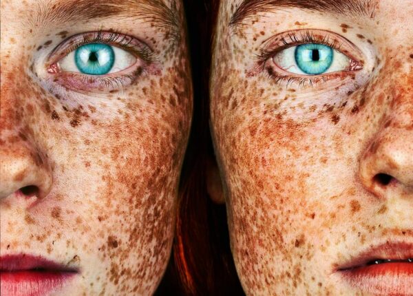 Нестандартная красота: 22 портрета фотографа Брока Элбанка