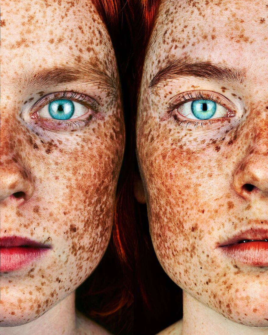 Портрет рыжеволосых близнецов с плотными веснушками по всему лицу &mdash; серия Freckles, Брок Элбанк