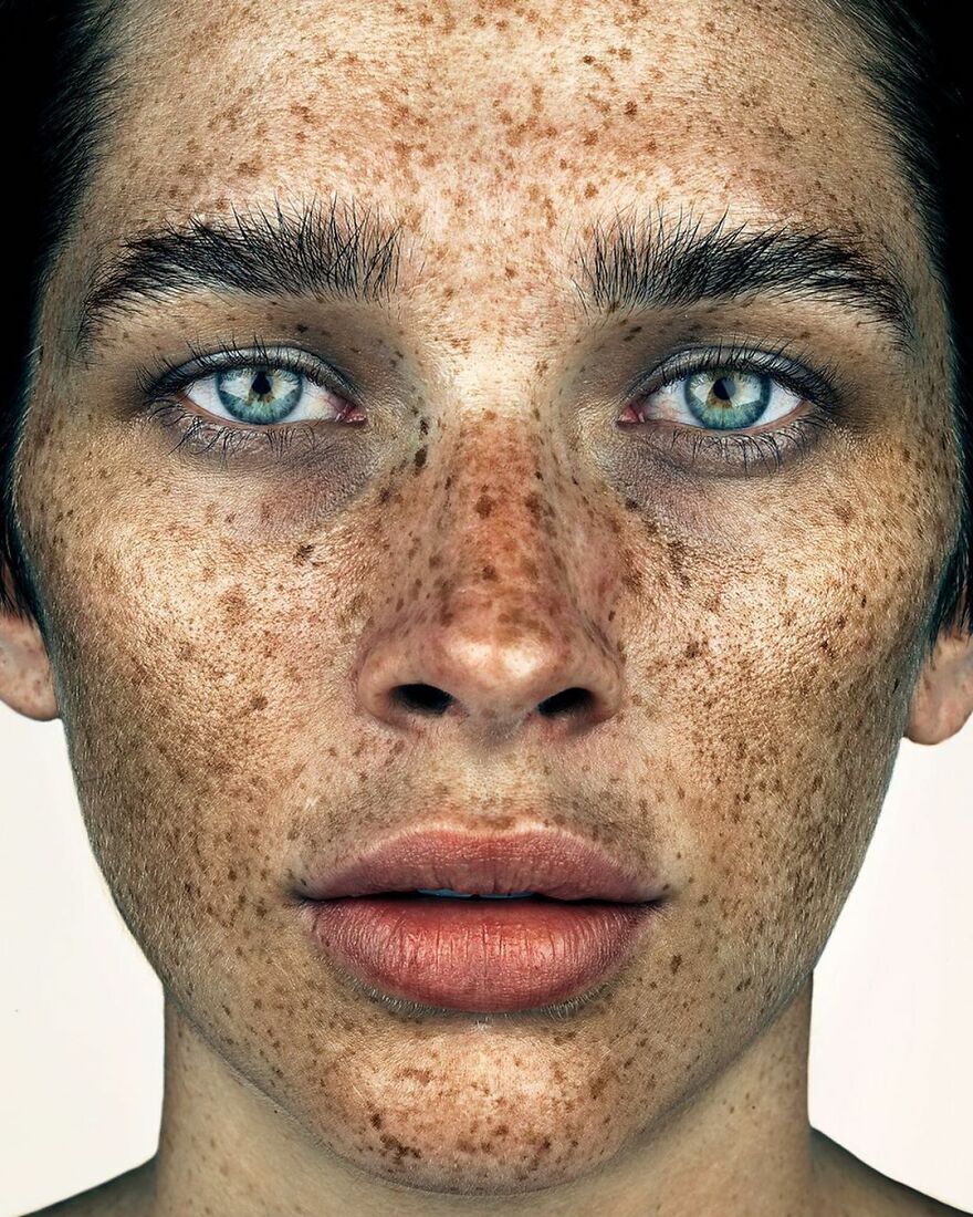 Портрет женщины с обильными веснушками по всему лицу, голубые глаза, прямой взгляд &mdash; Брок Элбанк