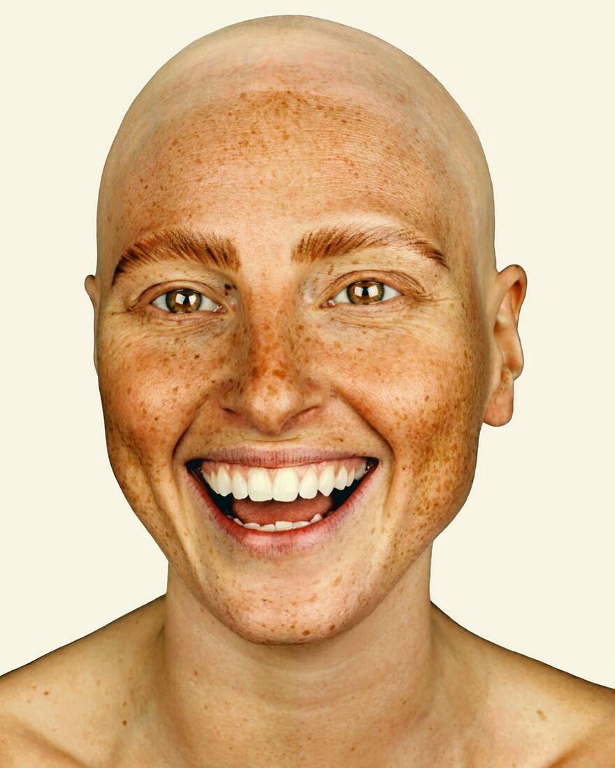 Портрет девушки с алопецией &mdash; лысая голова, татуированные брови, веснушки на лице, Брок Элбанк