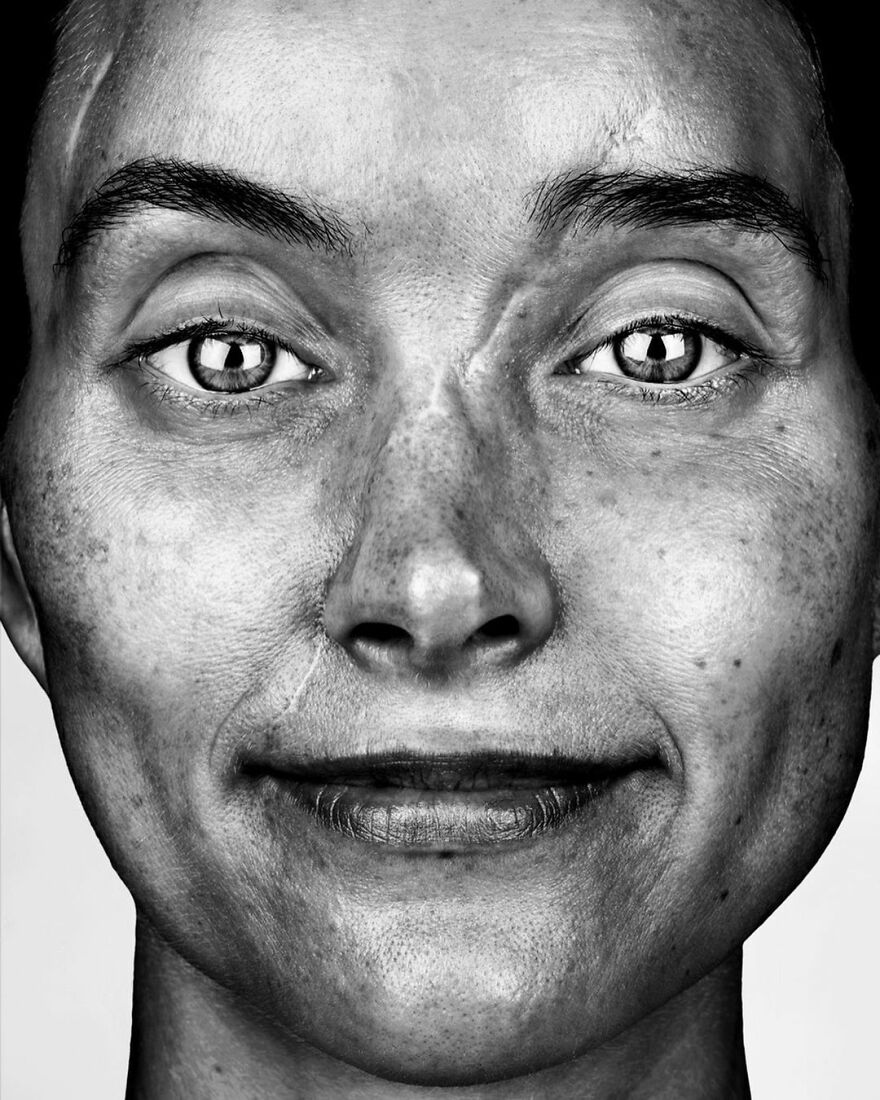 Женщина средних лет со шрамом через всё лицо, чёрно-белый портрет &mdash; серия Scars, Брок Элбанк