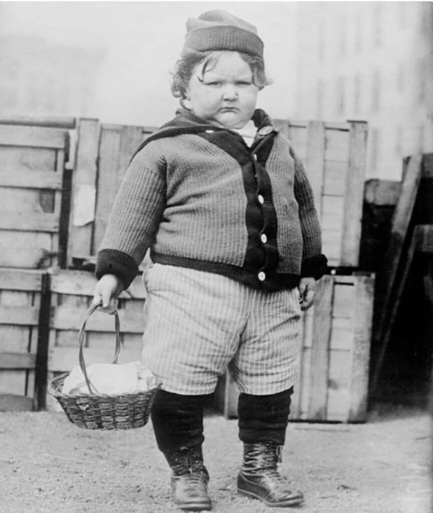 Bigpicture.ru История Джона Уилсона Уэбба - самого большого ребенка в мире