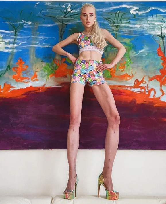 Bigpicture.ru немецкая модель Терезия Фишер (Theresia Fischer)