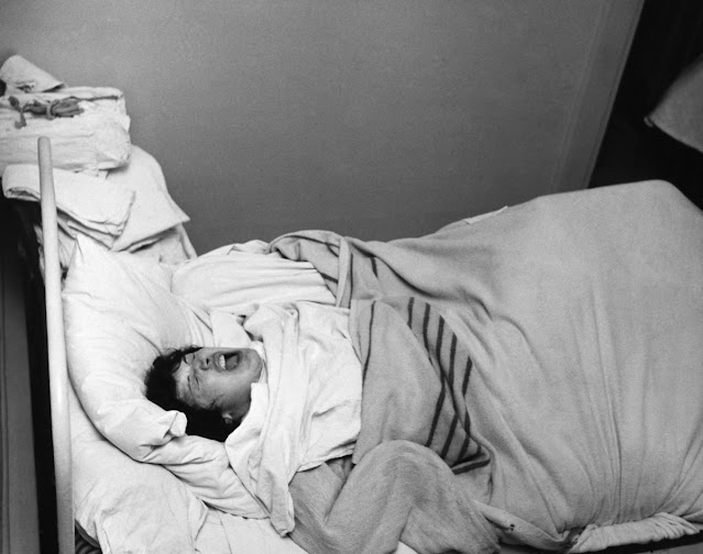 Пациент лежит на кровати с открытым ртом после процедуры