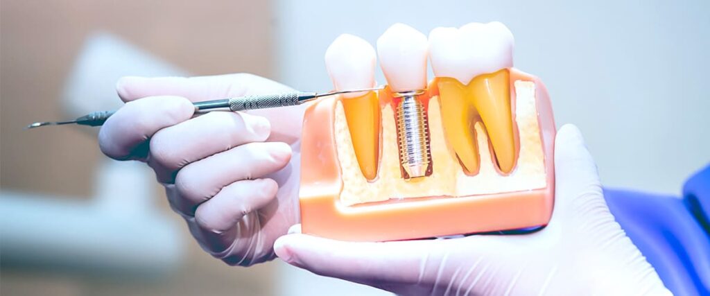 Bigpicture ru имплантология раменское