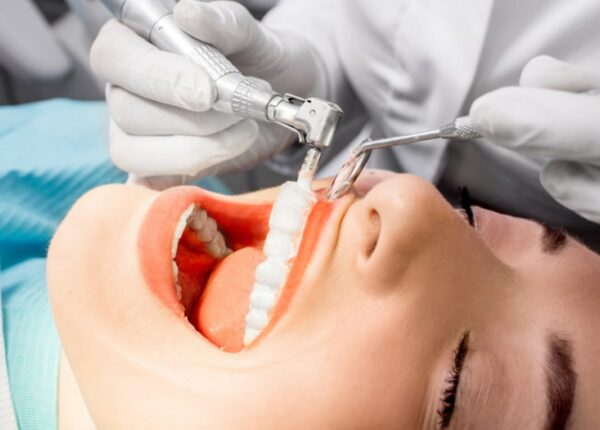 Лучшие стоматологические материалы и инструменты: что выбрать в интернет-магазине Мир стоматолога