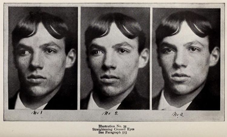 Исправление косоглазия на старинной фотографии