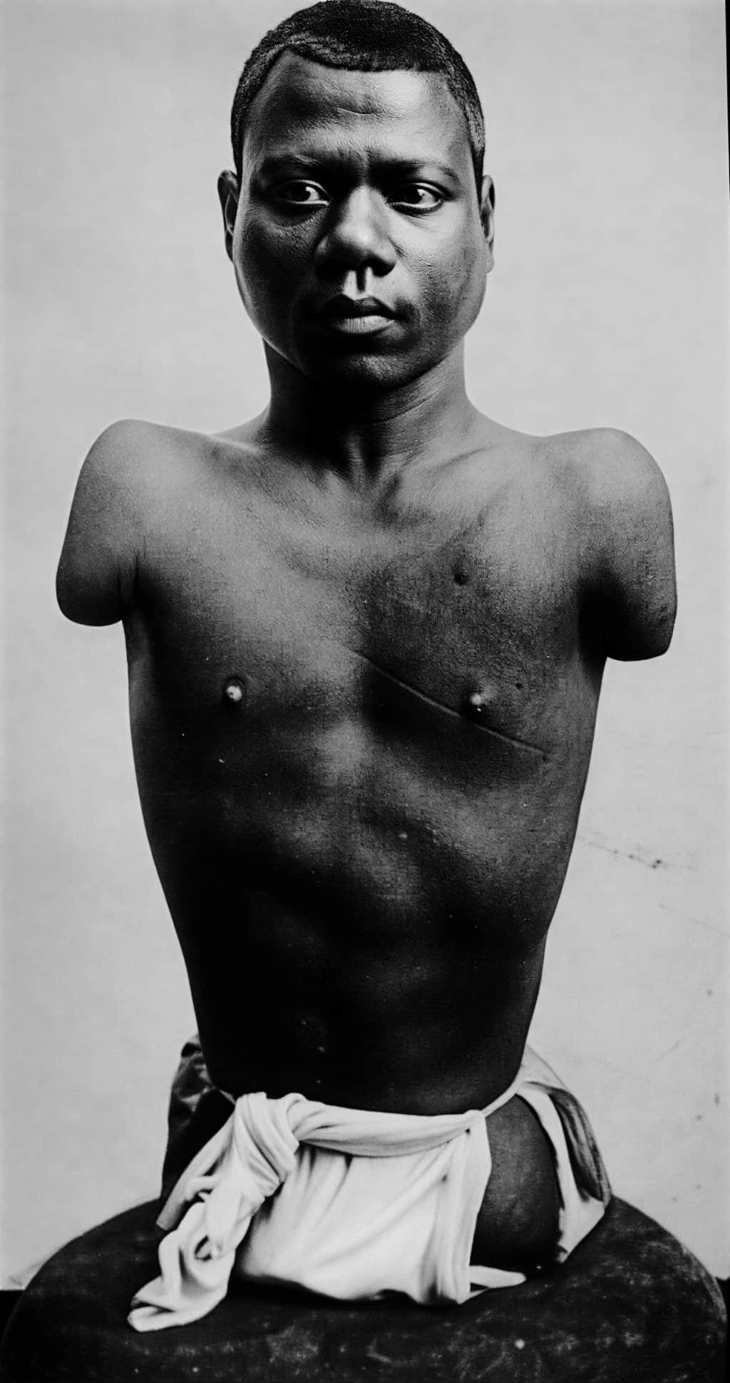 Молодой принц Рандиан без рук и ног, портрет начала XX века