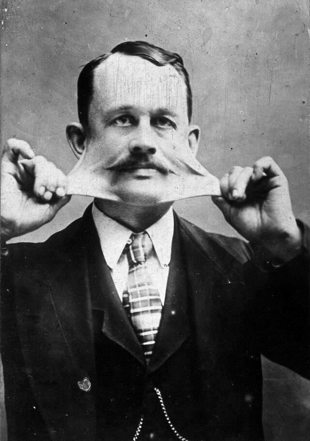 Джеймс Моррис рубцы кожа синдром Элерса-Данлоса фото артист фрик-шоу