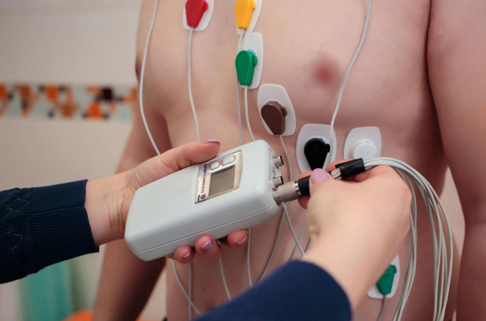 Bigpicture ru sutochnoe monitorirovanie ekg holter
