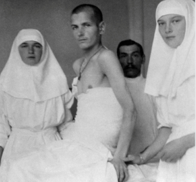 Выздоравливающий после сыпного тифа пациент с отросшими волосами, начало XX века