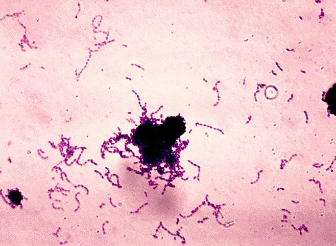 Бактерия Streptococcus mutans под микроскопом
