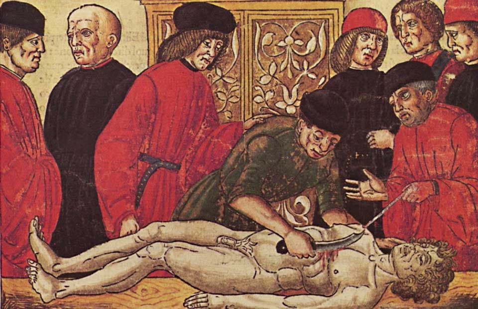 Средневековая иллюстрация &mdash; осмотр тела с целью установления причины смерти