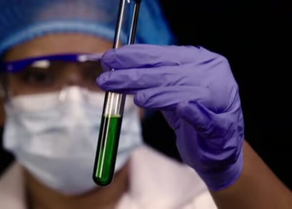 Может ли быть у человека зеленая кровь