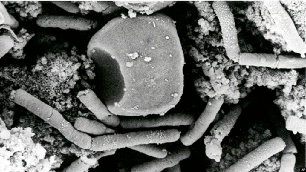 Микрофотография бактерий сибирской язвы (Bacillus anthracis) под электронным микроскопом