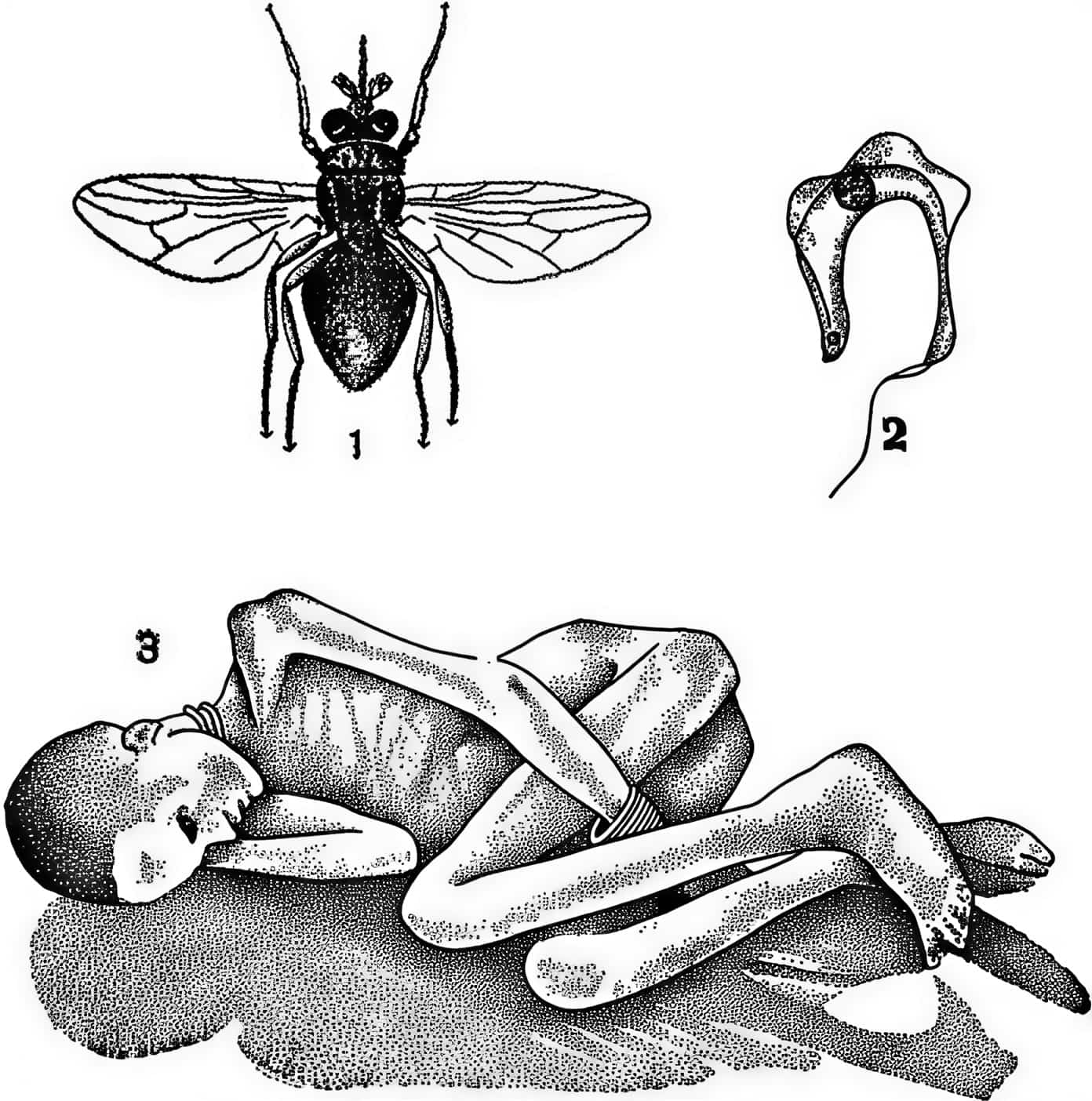 цикл передачи африканского трипаносомоза, более известного как сонная болезнь