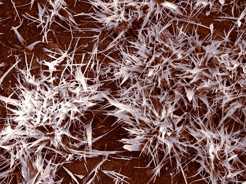 Микрофотография кристаллов какао-масла образующих белый налет на шоколаде