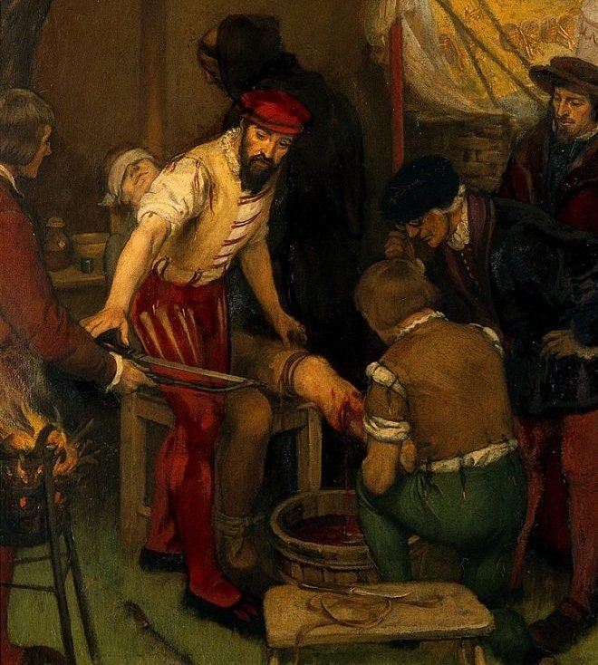 Деталь картины с корабельным плотником, проводящим ампутацию в трюме