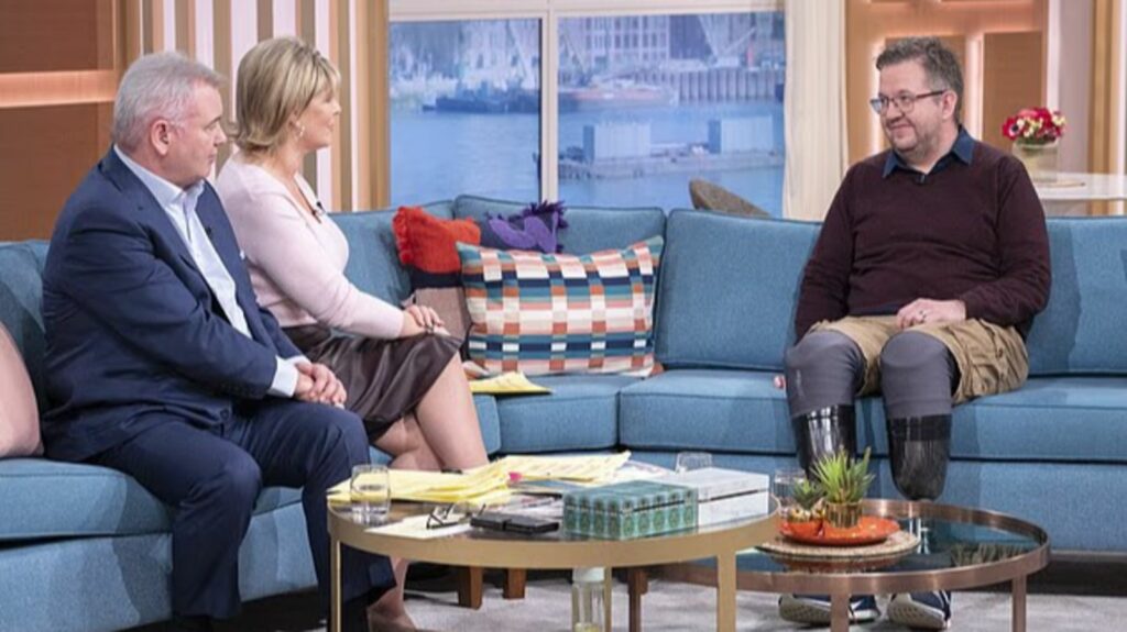 Нил Хоппер (Neil Hopper) на телешоу с протезами ног