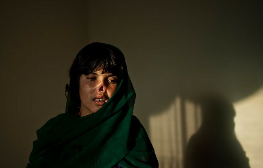 Женщина с отрезанными носом и ушами за провинность в Афганистане 2009 от Линси Аддарио (Lynsey Addario)