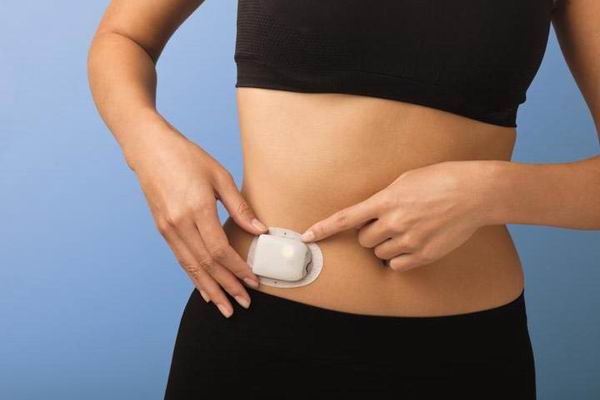 Инсулиновая помпа: устройство для непрерывной подачи инсулина