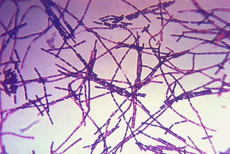 Микроснимок бацилл сибирской язвы (Bacillus anthracis)