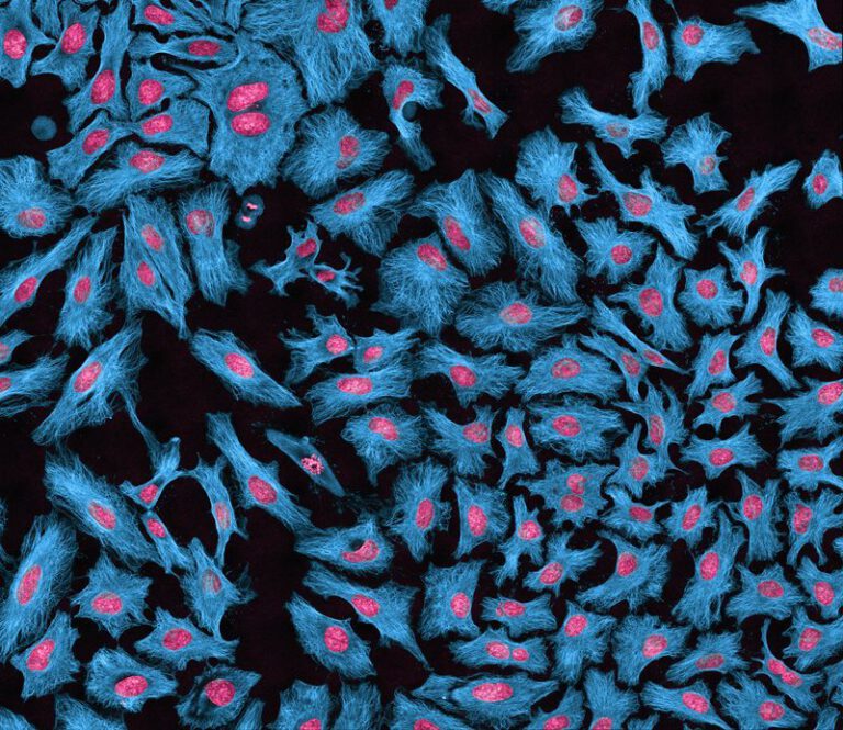 Снимок клеточной культуры HeLa под микроскопом