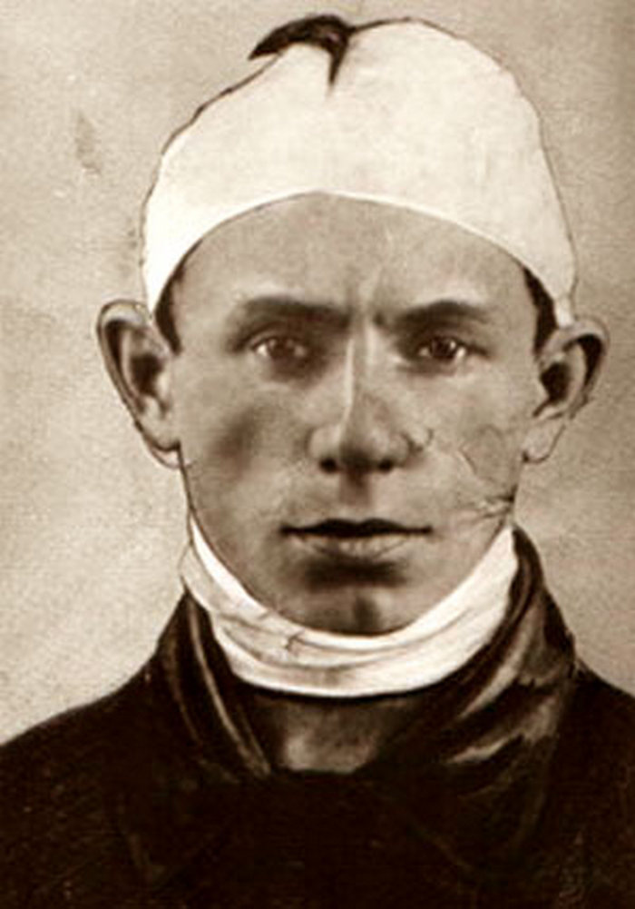 Ленька Пантелеев после ареста &mdash; голова перебинтована, 1922 год