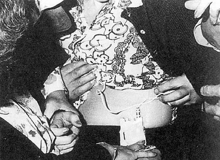 Радиопередатчик и антенны, которые Марта Петерсон носила под одеждой во время работы в Москве